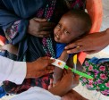 Mubashir getting his MUAC measurements taken in Ethiopia