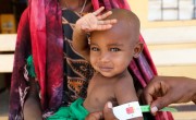 Halimo Hassan (1 year and 2 months) and mother Khayro Ali Hassan (30) in a remote health centre in Filtu, Somali Region. Halimo is being treated for severe acute malnutrition with the support of International NGO Concern Worldwide. Photo: Jennifer Nolan/ Concern Worldwide.