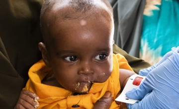 Small baby in yellow t-shirt eating and having tape wrapped around arm