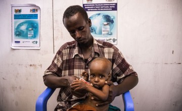 Man holding malnourished child on his lap, eating therapeutic food in health centre
