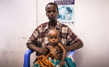 Concerned man sitting in blue plastic chair with child suffering from malnutrition sitting on his lap