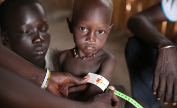 Two year old Bilan* being screened at a nutrition centre run by Concern Worldwide and Nile Hope in Unity State. Photo: Kieran McConville/Concern Worldwide. *name changed for security reasons.