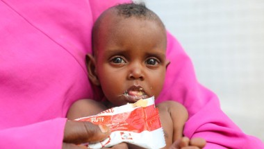 Nine month old Nala pictured here in a Concern supported health centre in Mogadishu, Somalia. Photo: Jennifer Nolan / Concern Worldwide