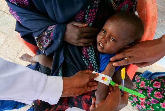 Mubashir getting his MUAC measurements taken in Ethiopia