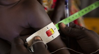 A child gets MUAC measurement assessed by a nutrition assistant at a Nutrition Centre in Gambella, Ethiopia.