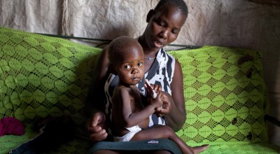 An 18-month-old Kenyan girl receives treatment for severe malnutrition