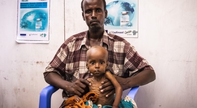 Concerned man sitting in blue plastic chair with child suffering from malnutrition sitting on his lap