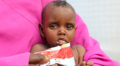 Nine month old Nala pictured here in a Concern supported health centre in Mogadishu, Somalia. Photo: Jennifer Nolan / Concern Worldwide